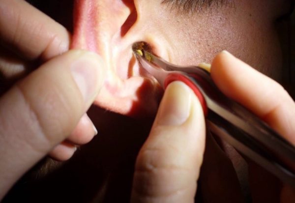 Ear Clean